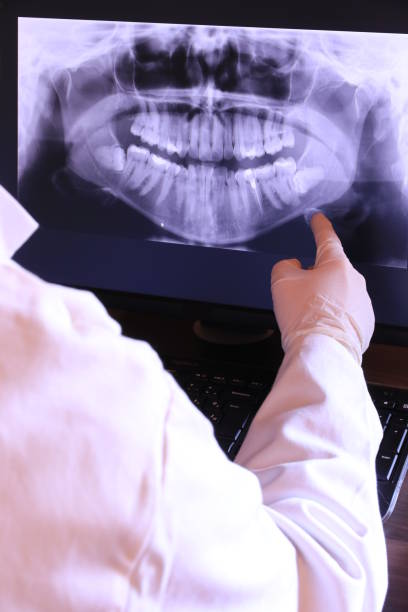 Best Emergency Tooth Extraction in Ogden, NC