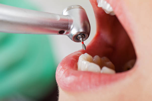 Emergency Treatment for Gum Disease